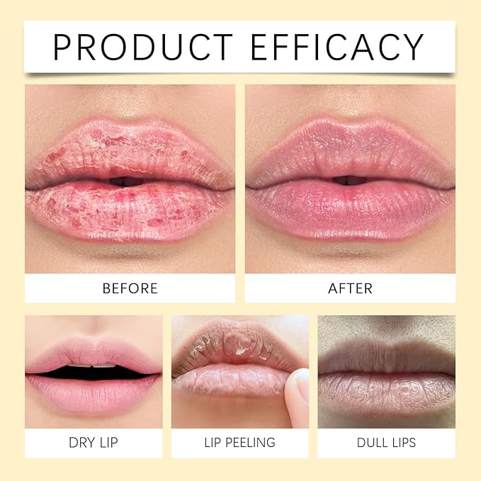 Lips Maximizer 5ml